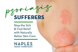 Psoriasis Sufferers - Find Relief Naturally