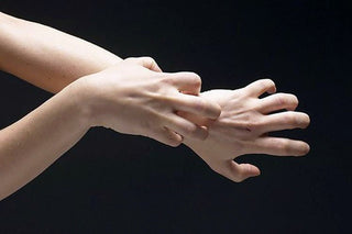 Is Eczema Contagious? FAQs Answered