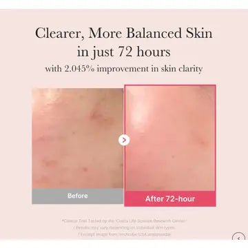 Medicube TXA Niacinamide 15 serum balanced skin